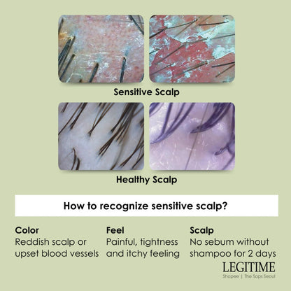 LEGITIME Sensitive Scalp Treatment