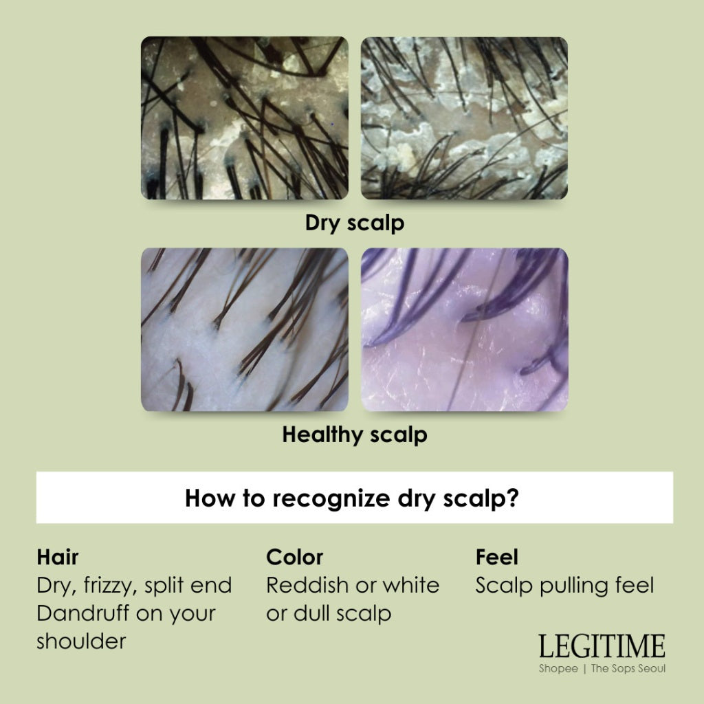 LEGITIME 3-Step Scalp Treatment