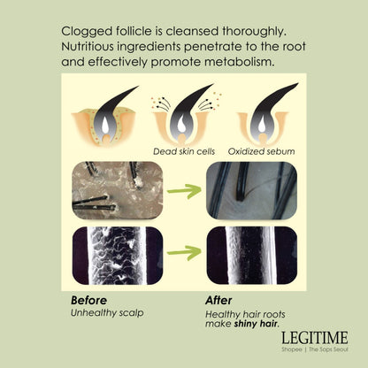 LEGITIME 3-Step Scalp Treatment